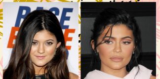 The Era of Plastic Surgery Regret Is Here