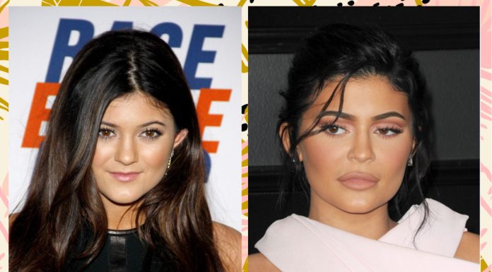 The Era of Plastic Surgery Regret Is Here